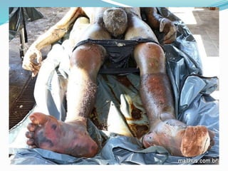 FENÔMENOS CADAVÉRICOS  E SUAS TRANSFORMAÇÕES