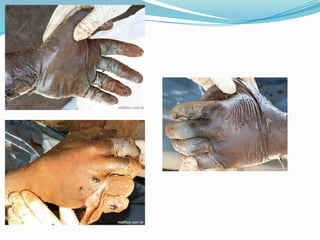 FENÔMENOS CADAVÉRICOS  E SUAS TRANSFORMAÇÕES