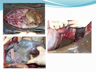 FENÔMENOS CADAVÉRICOS  E SUAS TRANSFORMAÇÕES