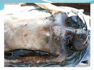 FENÔMENOS CADAVÉRICOS  E SUAS TRANSFORMAÇÕES