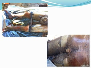 FENÔMENOS CADAVÉRICOS  E SUAS TRANSFORMAÇÕES