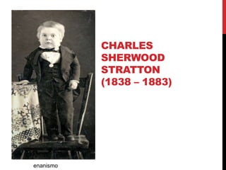 CHARLES
SHERWOOD
STRATTON
(1838 – 1883)
enanismo
 