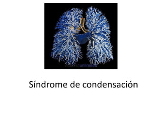 Síndrome de condensación
 