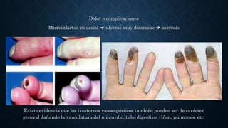 Dolor o complicaciones
Microinfartos en dedos  ulceras muy dolorosas  necrosis
Existe evidencia que los trastornos vasoespásticos también pueden ser de carácter
general dañando la vasculatura del miocardio, tubo digestivo, riñon, pulmones, etc.
 
