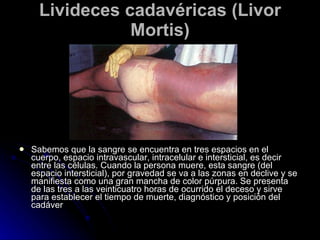 Livideces cadavéricas (Livor Mortis) Sabemos que la sangre se encuentra en tres espacios en el cuerpo, espacio intravascular, intracelular e intersticial, es decir entre las células. Cuando la persona muere, esta sangre (del espacio intersticial), por gravedad se va a las zonas en declive y se manifiesta como una gran mancha de color púrpura. Se presenta de las tres a las veinticuatro horas de ocurrido el deceso y sirve para establecer el tiempo de muerte, diagnóstico y posición del cadáver  