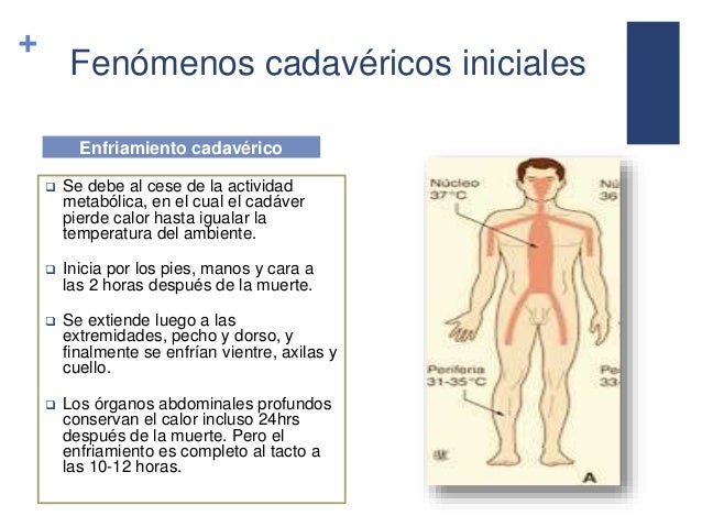 Fenómenos cadavéricos