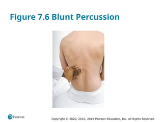 Copyright © 2020, 2016, 2012 Pearson Education, Inc. All Rights Reserved
Figure 7.6 Blunt Percussion
 