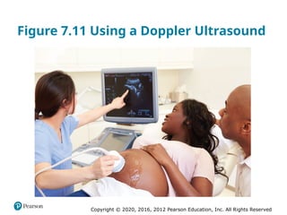 Copyright © 2020, 2016, 2012 Pearson Education, Inc. All Rights Reserved
Figure 7.11 Using a Doppler Ultrasound
 