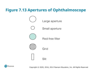 Copyright © 2020, 2016, 2012 Pearson Education, Inc. All Rights Reserved
Figure 7.13 Apertures of Ophthalmoscope
 