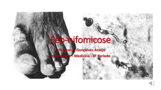 Feo-hifomicose
Erik Ricardo Gonçalves Araújo
Infectologia – Medicina - 4º Período
 