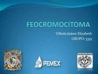 FEOCROMOCITOMA Villeda Juárez Elizabeth GRUPO: 3335 
