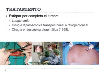 TRATAMIENTO


Extirpar por completo el tumor:




Lapatotomía.
Cirugía laparoscópica transperitoneal o retroperitoneal.
Cirugía endoscópica atraumática (1995).

 
