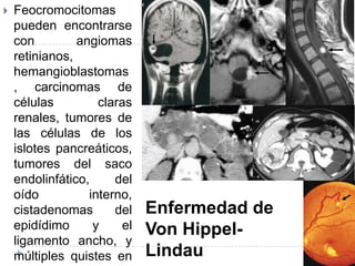 

Feocromocitomas
pueden encontrarse
con
angiomas
retinianos,
hemangioblastomas
, carcinomas de
células
claras
renales, tumores de
las células de los
islotes pancreáticos,
tumores del saco
endolinfático,
del
oído
interno,
cistadenomas
del
epidídimo
y
el
ligamento ancho, y
múltiples quistes en

Enfermedad de
Von HippelLindau

 