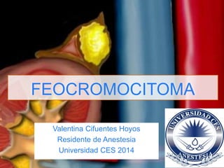 FEOCROMOCITOMA
Valentina Cifuentes Hoyos
Residente de Anestesia
Universidad CES 2014
 