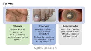 Otros:
Tiña negra
Hortaea weneckii
Placas café
aterciopaladas con
predilección por palmas
y plantas
Onicomicosis
Scytalidium hyalinum y
Neoscutalidium
dimidiatum
Similar a dermatofitosis
con afección subungual
distal y paroniquia
Queratitis micótica
Aspergillus y Fusarium,
generalmente asociado
a trauma, diabetes y
lentes de contacto
Rev CES Med 2016. 30(1): 66-77.
 