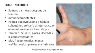 QUISTE MICÓTICO
• Semanas a meses después de
trauma
• Inmunocompetentes
• Pápula que evoluciona a nódulo
subcutáneo solitario asintomático o
en ocasiones quiste lleno de pus
• También: celulitis, placas ulceradas,
lesiones vegetantes
• Más frecuente: pies, manos,
rodillas, codos, piernas y antebrazos
Actas Dermosifilogr. 2016;107(10):806-815.
 