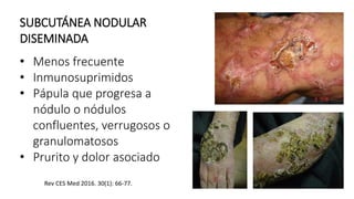 SUBCUTÁNEA NODULAR
DISEMINADA
• Menos frecuente
• Inmunosuprimidos
• Pápula que progresa a
nódulo o nódulos
confluentes, verrugosos o
granulomatosos
• Prurito y dolor asociado
Rev CES Med 2016. 30(1): 66-77.
 