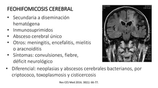FEOHIFOMICOSIS CEREBRAL
• Secundaria a diseminación
hematógena
• Inmunosuprimidos
• Absceso cerebral único
• Otros: meningitis, encefalitis, mielitis
o aracnoiditis
• Síntomas: convulsiones, fiebre,
déficit neurológico
Rev CES Med 2016. 30(1): 66-77.
• Diferencial: neoplasias y abscesos cerebrales bacterianos, por
criptococo, toxoplasmosis y cisticercosis
 