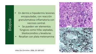 Biopsia
• En dermis e hipodermis lesiones
encapsuladas, con reacción
granulomatosa inflamatoria con
necrosis central.
• Se pueden ver elementos
fúngicos como hifas septadas,
blastoconidios y levaduras
• Resaltan con plata metenamina
Infect Dis Clin N Am. 2006; 20: 609-620.
 