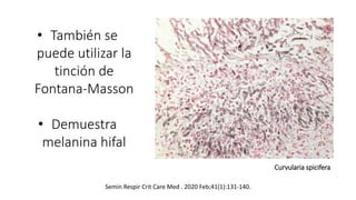 • También se
puede utilizar la
tinción de
Fontana-Masson
• Demuestra
melanina hifal
Curvularia spicifera
Semin Respir Crit Care Med . 2020 Feb;41(1):131-140.
 