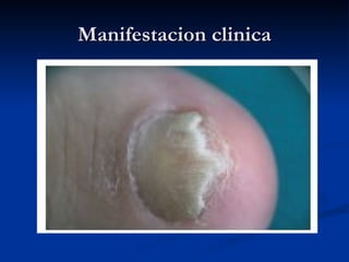 Manifestacion clinica
Manifestacion clinica
 