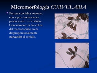 Micromorfología
Micromorfología CURVULARIA
CURVULARIA
 Presenta conidios oscuros,
Presenta conidios oscuros,
con septos horizontales,
con septos horizontales,
produciendo 3 a 5 células.
produciendo 3 a 5 células.
Generalmente la 3ra célula
Generalmente la 3ra célula
del macroconidio crece
del macroconidio crece
desproporcionalmente
desproporcionalmente
curvando
curvando el conidio.
el conidio.
 