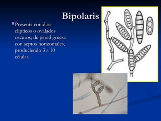 Bipolaris
Bipolaris
Presenta conidios
Presenta conidios
elipticos o ovalados
elipticos o ovalados
oscuros, de pared gruesa
oscuros, de pared gruesa
con septos horizontales,
con septos horizontales,
produciendo 3 a 10
produciendo 3 a 10
células.
células.
 