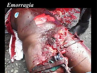 Emorragia 