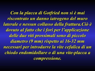Con la placca di Gotfried non si è mai riscontrato un danno iatrogeno del muro laterale e nessun collasso della frattura.Ciò è dovuto al fatto che i fori per l’applicazione delle due viti prossimali sono di piccolo diametro (9 mm) rispetto ai 16-32 mm necessari per introdurre la vite cefalica di un chiodo endomidollare o di una vite-placca a compressione. 