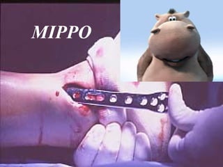 MIPPO 
