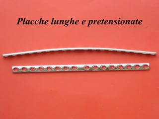 Placche lunghe e pretensionate 