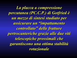 La placca a compressione percutanea (PC.C.P.) di Gotfried è un mezzo di sintesi studiato per assicurare un “impattamento controllato” delle fratture pertrocanteriche grazie alle due viti telescopiche prossimali che garantiscono una ottima stabilità rotazionale 