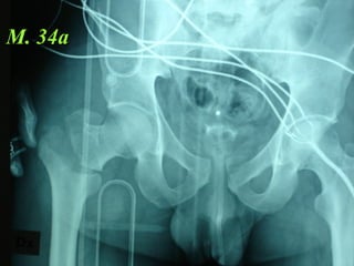 M. 34a 