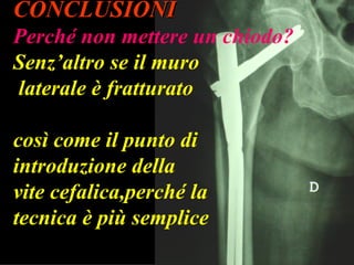 CONCLUSIONI Perché non mettere un chiodo?  Senz’altro se il muro  laterale è fratturato  così come il punto di introduzione della  vite cefalica,perché la tecnica è più semplice 