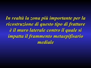 In realtà la zona più importante per la ricostruzione di questo tipo di fratture è il muro laterale contro il quale si impatta il frammento metaepifisario mediale 