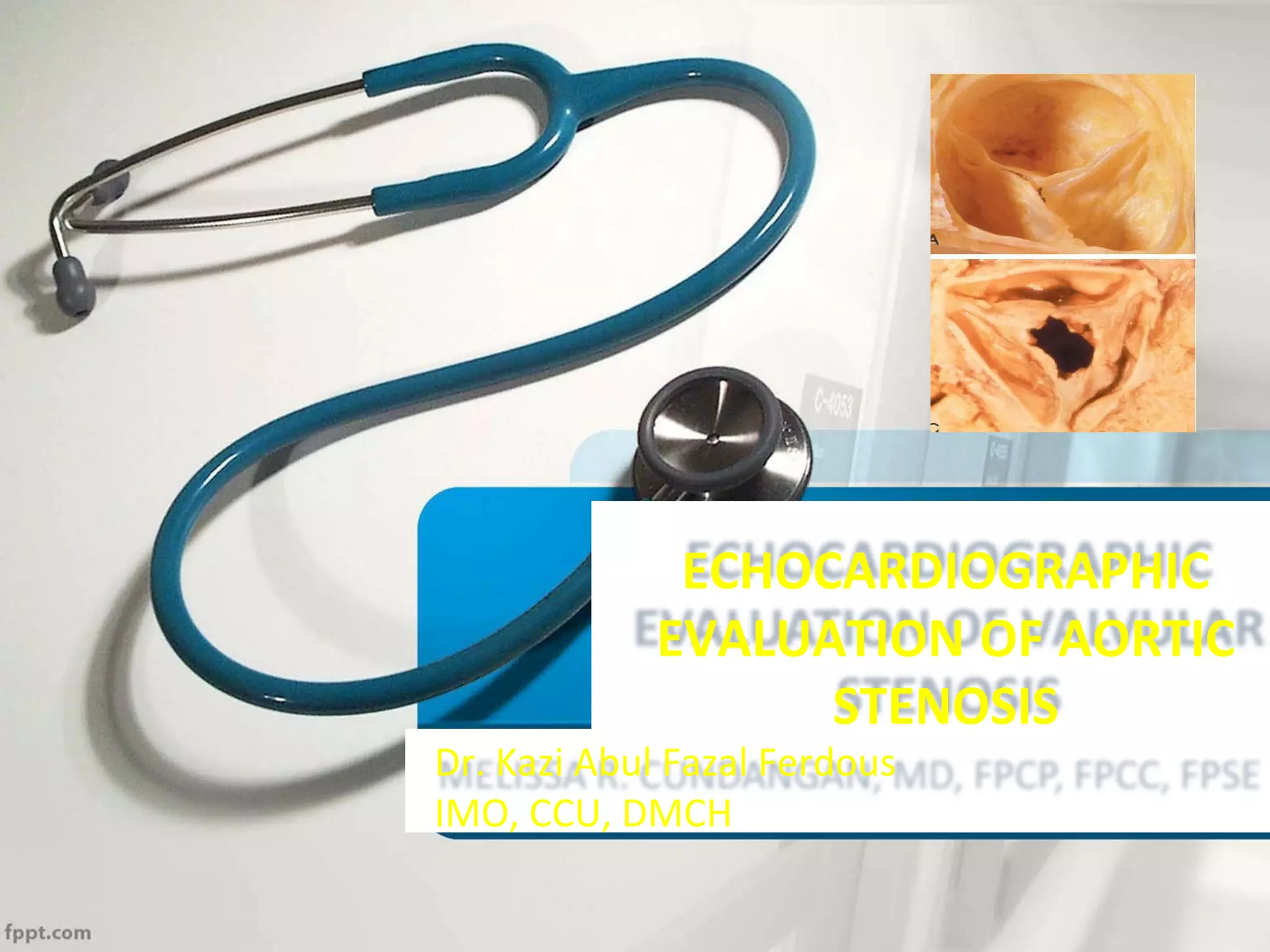 Echo assessment of Aortic valve disease, Dr Ferdous assistant registrar ...