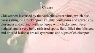 Causes
Chickenpox is caused by the varicella-zoster virus, which also
causes shingles. Chickenpox is highly contagious and spreads by
closeness and contact with someone with chickenpox. Fever,
malaise, and a very itchy rash (red spots, fluid-filled tiny blisters,
and crusted lesions) are all symptoms and signs of chickenpox.
 
