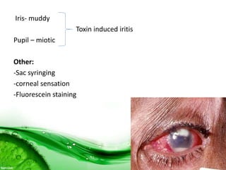 Iris- muddy
Toxin induced iritis
Pupil – miotic
Other:
-Sac syringing
-corneal sensation
-Fluorescein staining
 