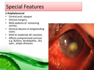 Special Features
1.Staphylococcal
• Central,oval, opaque
• Distinct margins.
• Mild oedema of remaining
cornea.
• Stromal abscess in longstanding
cases.
• Mild to moderate AC reaction.
• Affects compromised corneas
e.g. Bullous keratopathy , dry
eyes , atopic diseases.
 