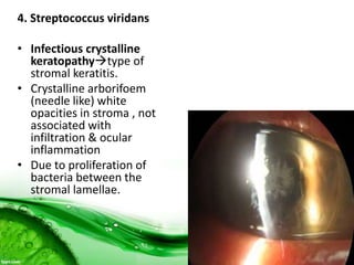 4. Streptococcus viridans
• Infectious crystalline
keratopathytype of
stromal keratitis.
• Crystalline arborifoem
(needle like) white
opacities in stroma , not
associated with
infiltration & ocular
inflammation
• Due to proliferation of
bacteria between the
stromal lamellae.
 