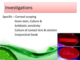 Investigations
Specific – Corneal scraping
Gram stain, Culture &
Antibiotic sensitivity
Culture of contact lens & solution
Conjunctival Swab
 