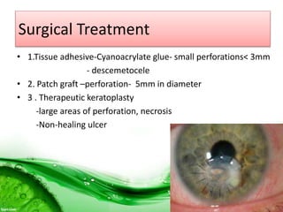Surgical Treatment
• 1.Tissue adhesive-Cyanoacrylate glue- small perforations< 3mm
- descemetocele
• 2. Patch graft –perforation- 5mm in diameter
• 3 . Therapeutic keratoplasty
-large areas of perforation, necrosis
-Non-healing ulcer
 