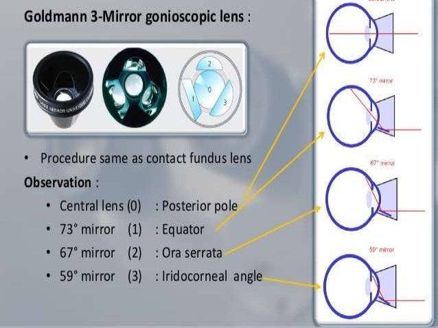 Ocular Magna View Two Mirror Gonio
