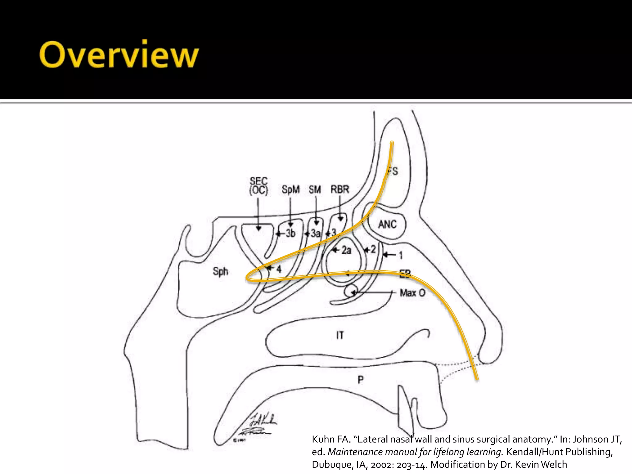 その他 SBC Sinus Approach Course DVD DVD】Surgical Basic Course 歯周形成外科コース ｜SBC歯周形成外科