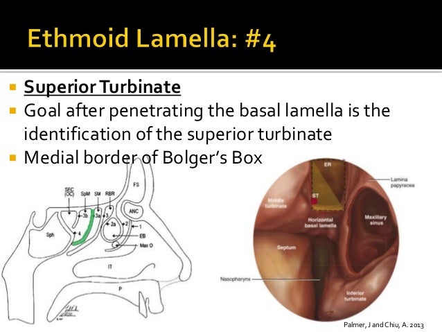 Sinus Anatomy Lectures: Western Residents Advanced Endsocopic Sinus S…