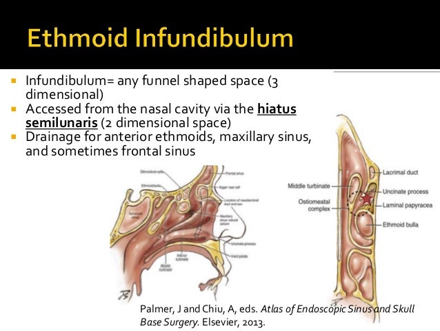 Sinus Anatomy Lectures: Western Residents Advanced Endsocopic Sinus S…