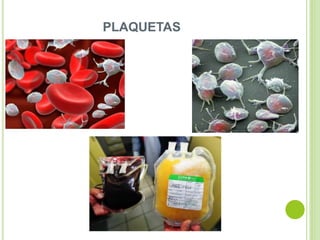 PLAQUETAS
 