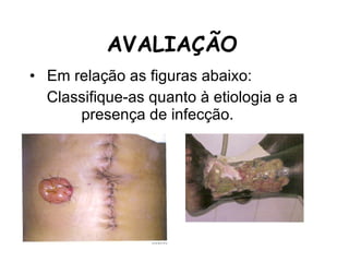 AVALIAÇÃO Em relação as figuras abaixo: Classifique-as quanto à etiologia e a  presença de infecção. 