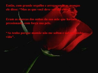 Então, com grande orgulho e arregaçando as mangas
ele disse: “Mas as que você deve ver são estas".
Eram as marcas das unhas da sua mãe que haviam
pressionado com força sua pele.
“As tenho porque mamãe não me soltou e salvou minha
vida".
 