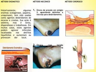 MÉTODO ENZIMÁTICO

MÉTODO MECÂNICO 

historicamente,
algumas 1. Úlcera de pressão em estágio
2, aguardando delimitar a
enzimas (colagenase, papaína,
necrose para desbridamento.
uroquinase), tem sido usadas
como agentes desbridantes de
escaras e crostas. Sua ação é
seletiva,
mas
é
lenta,
dispendiosas e trabalhosas. Em
muitos casos, estes agentes
podem
agravar
infecções
localizadas
nos
detritos
liquefeitos e aumentam ou
provocam
dor
local.

2.

Úlcera
com
tecido
necrótico pronta para
desbridamento.

MÉTODO CIRÚRGICO

 
